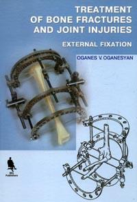 Oganesyan, Oganes V.: Treatment of Bone Fractures and Joint Injuries: External Fixation